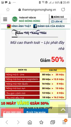 có nên nâng mũi bằng sụn tự thân