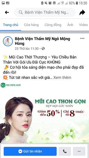 giá nâng mũi bằng eptfe