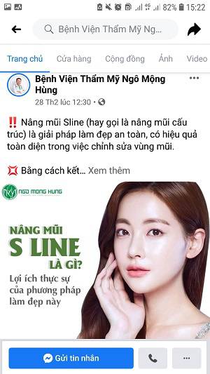 giá nâng mũi bằng eptfe