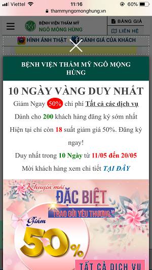 địa chỉ nâng mũi đẹp ở Sài Gòn