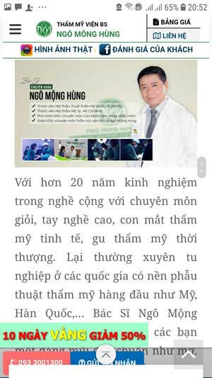 chi phí nâng mũi gồ