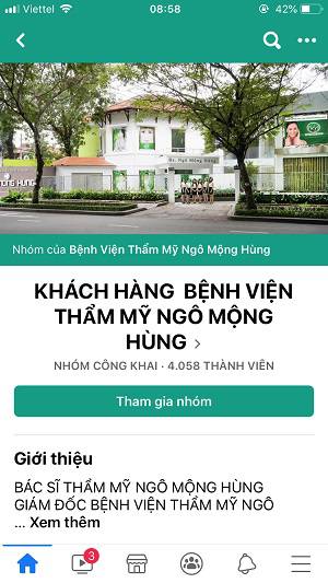 chi phí nâng mũi gồ