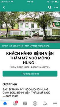 cắt chỉ nâng ngực nội soi