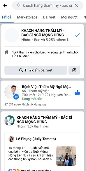 cắt mí mắt trên