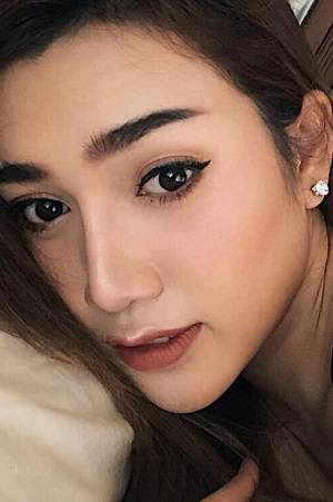 nâng mũi không phẫu thuật ở sài gòn