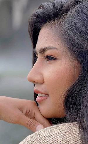 nâng mũi không phẫu thuật bằng juvederm