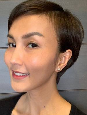 treo chân mày nội soi